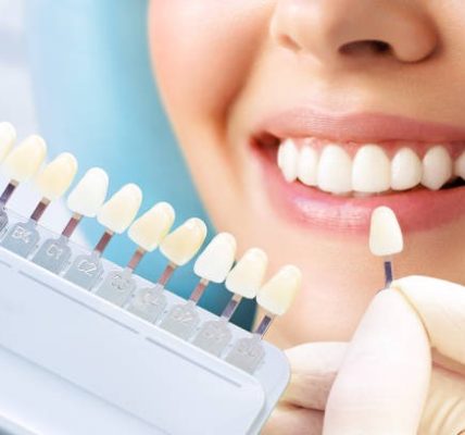 Discover Quality Care at Small Dental for Your Oral Health Needs